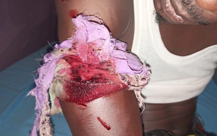 One shot, police, electoral officers scamper to safety at Ondo APC primaries 1 APC