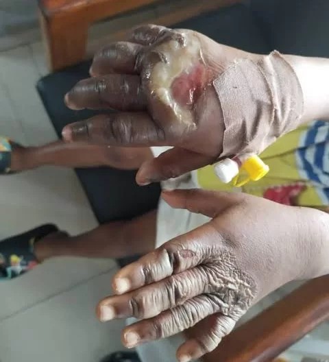 Middle aged woman in police net for burning granddaughter’s hand in hot water 1 Grandma