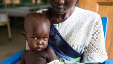 Urgent action needed as acute malnutrition threatens lives of millions of vulnerable children 6 UN0232174