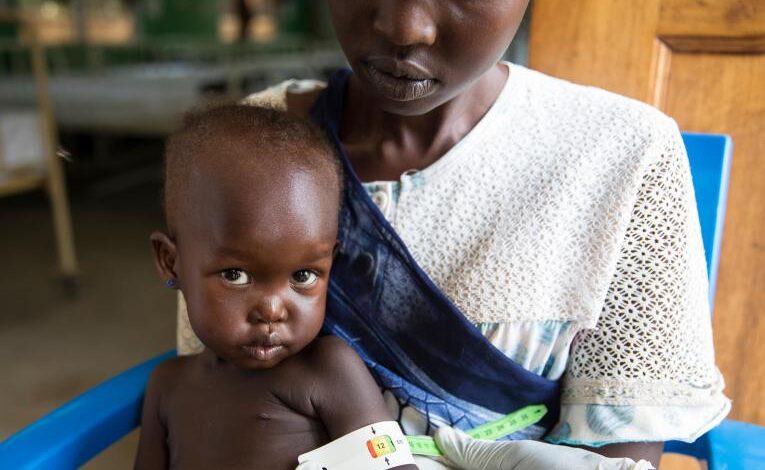 Urgent action needed as acute malnutrition threatens lives of millions of vulnerable children 1 UN0232174
