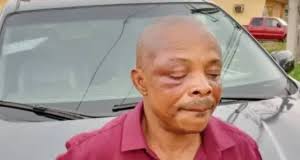 Brutalisation of Ajaero: Matters miscellaneous, By Ray Ekpu 9 images 2023 11 10T193612.381