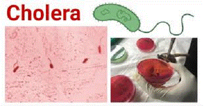 No reported case of cholera in Osun, says Govt 1 Cholera