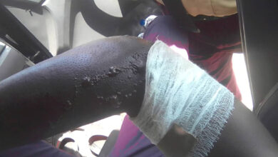 LASTMA official set ablaze in violent attack by commercial bus driver 10 1730815830914557 0