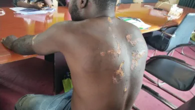 Osun lounge owner cries out after alleged police assault, demands justice 4 IMG 20251106 WA0047