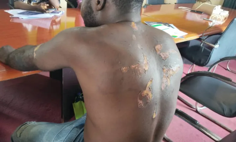 Osun lounge owner cries out after alleged police assault, demands justice 1 IMG 20251106 WA0047