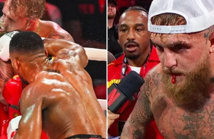 Jake Paul rushed to hospital after defeat by Anthony Joshua 3 IMG 20251220 WA0016