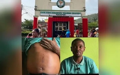 Ekiti teacher accuses teaching hospital of wrongful kidney removal 1