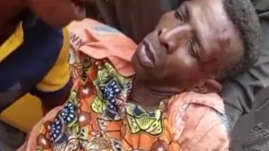 Heavy-duty truck loses control on Eko bridge, injures LAWMA worker 7 FB IMG 1770379509321