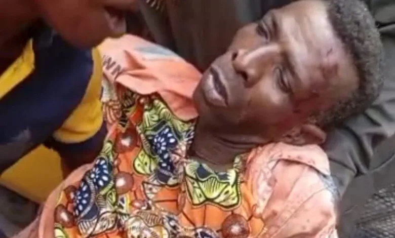 Heavy-duty truck loses control on Eko bridge, injures LAWMA worker 1 FB IMG 1770379509321