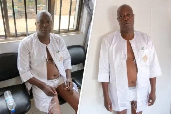 Suspected thugs assault, strip Owo council chairman 1 954a5d46 c673 44ef b990 2633cff3a227