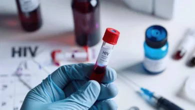 Lagos tops list of Nigeria’s over 102,000 new HIV/AIDs infections 8 images 2026 07 01T023620.534