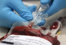 Jehovah’s Witnesses unveil latest update to blood transfusion policy 2 images 2026 09 19T184907.976