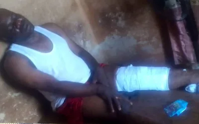 Biker fleeing arrest fractures FRSC officer’s leg in Ekiti 1 IMG 3430