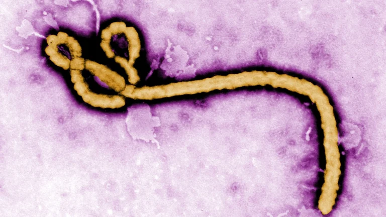 FG confirms Ebola case in Abuja, traces 44 contacts 1 IMG 3789
